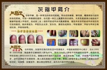 恒景堂灰指甲修复加盟怎么样