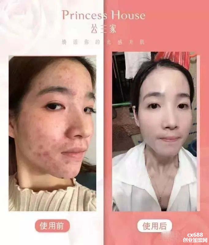 兰蔻护肤品怎么样,兰蔻护肤品护肤好不好