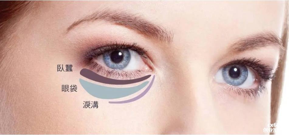 关于眼袋的三大误区怎么去除眼袋